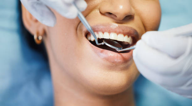 Best Chipped Tooth Repair Near Me  in Columbiana, AL